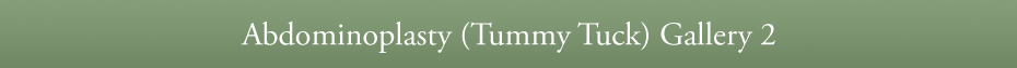 Abdominoplasty (Tummy Tuck) Gallery 2