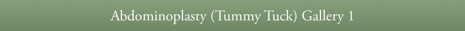 Abdominoplasty (Tummy Tuck) Gallery 1