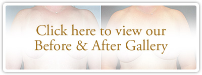 Click here to view our Before & After Gallery