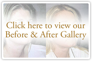 Click here to view our Before & After Gallery