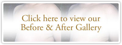 Click here to view our Before & After Gallery