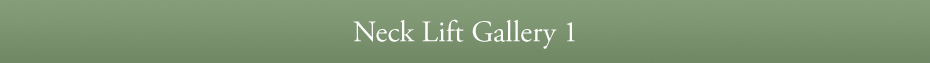 Neck Lift Gallery 1