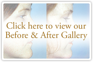 Click here to view our Before & After Gallery